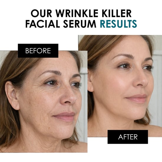 skinChemists Faltenbekämpfendes Anti-Aging-Gesichtsserum 30 ml - Image 3