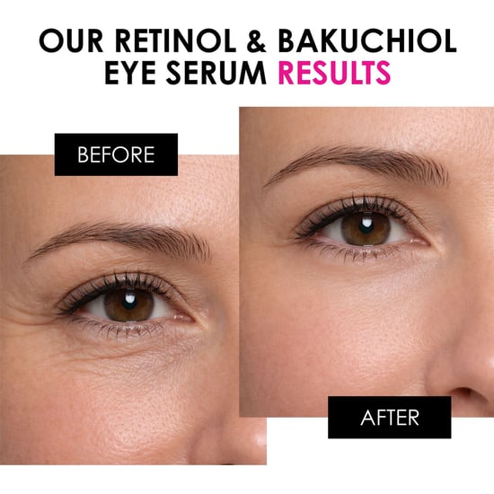 skinChemists Retinol & Bakuchiol Anti-Aging Augenserum 15 ml - Image 3